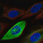 Merck Anti-HMMR antibody produced in rabbit