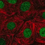 Merck Anti-RITA1 antibody produced in rabbit