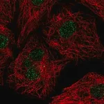 Merck Anti-U2AF1L4 antibody produced in rabbit