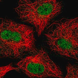 Merck Anti-ZNF618 antibody produced in rabbit
