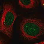 Merck Anti-PSMB5 antibody produced in rabbit