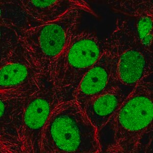 Merck Anti-SMARCC2 antibody produced in rabbit