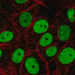 Merck Anti-SMARCC2 antibody produced in rabbit