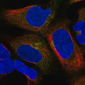 Merck Anti-UBXN6 antibody produced in rabbit