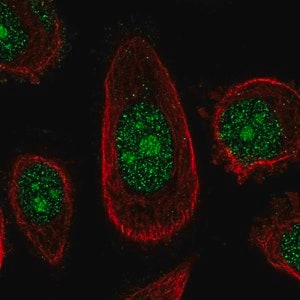 Merck Anti-ZNF16 antibody produced in rabbit