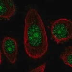 Merck Anti-ZNF16 antibody produced in rabbit