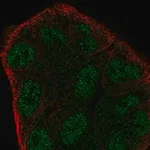 Merck Anti-ZMYM6 antibody produced in rabbit