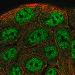 Merck Anti-TNIP1 antibody produced in rabbit