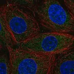 Merck Anti-CCDC9 antibody produced in rabbit