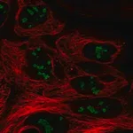 Merck Anti-CC2D2B antibody produced in rabbit