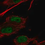 Merck Anti-HOXC9 antibody produced in rabbit