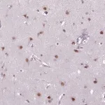 Merck Anti-MAGEB3 antibody produced in rabbit
