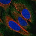 Merck Anti-ZDHHC22 antibody produced in rabbit