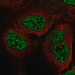 Merck Anti-RFPL3 antibody produced in rabbit
