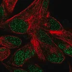 Merck Anti-POLR3F antibody produced in rabbit
