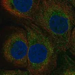 Merck Anti-TAP1 antibody produced in rabbit