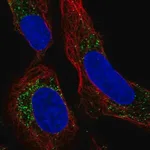 Merck Anti-PMEPA1 antibody produced in rabbit