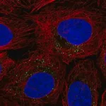 Merck Anti-ROS1 antibody produced in rabbit