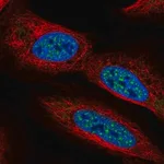 Merck Anti-CBFA2T2 antibody produced in rabbit