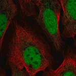 Merck Anti-YEATS4 antibody produced in rabbit