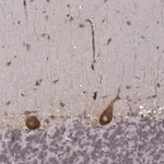 Merck Anti-TMEM14A antibody produced in rabbit
