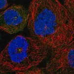 Merck Anti-SDCCAG8 antibody produced in rabbit