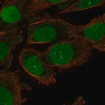 Merck Anti-ORC6 antibody produced in rabbit