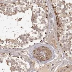 Merck Anti-PICK1 antibody produced in rabbit