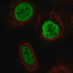 Merck Anti-YTHDC2 antibody produced in rabbit