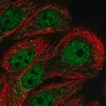 Merck Anti-PPP1R3F antibody produced in rabbit