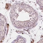 Merck Anti-AMMECR1 antibody produced in rabbit