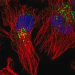 Merck Anti-ACSL4 antibody produced in rabbit