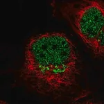 Merck Anti-IL13RA1 antibody produced in rabbit