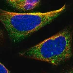 Merck Anti-TOM1 antibody produced in rabbit