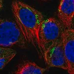 Merck Anti-SYAP1 antibody produced in rabbit