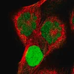Merck Anti-KCND1 antibody produced in rabbit