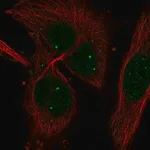 Merck Anti-HIF1A antibody produced in rabbit