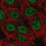 Merck Anti-LHX2 antibody produced in rabbit