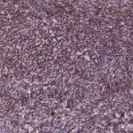 Merck Anti-ZNF630 antibody produced in rabbit