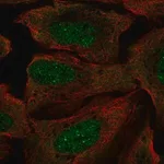 Merck Anti-RP2 antibody produced in rabbit