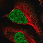 Merck Anti-MNAT1 antibody produced in rabbit