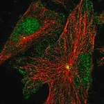 Merck Anti-PRICKLE3 antibody produced in rabbit