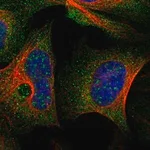Merck Anti-TSC22D3 antibody produced in rabbit