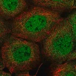 Merck Anti-PIK3C2B antibody produced in rabbit
