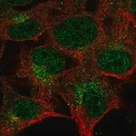 Merck Anti-CTSK antibody produced in rabbit