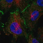 Merck Anti-TP53BP2 antibody produced in rabbit