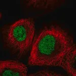 Merck Anti-METTL1 antibody produced in rabbit