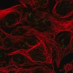 Merck Anti-RPL7L1 antibody produced in rabbit