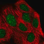 Merck Anti-XRN2 antibody produced in rabbit