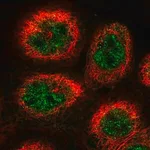 Merck Anti-COPS3 antibody produced in rabbit